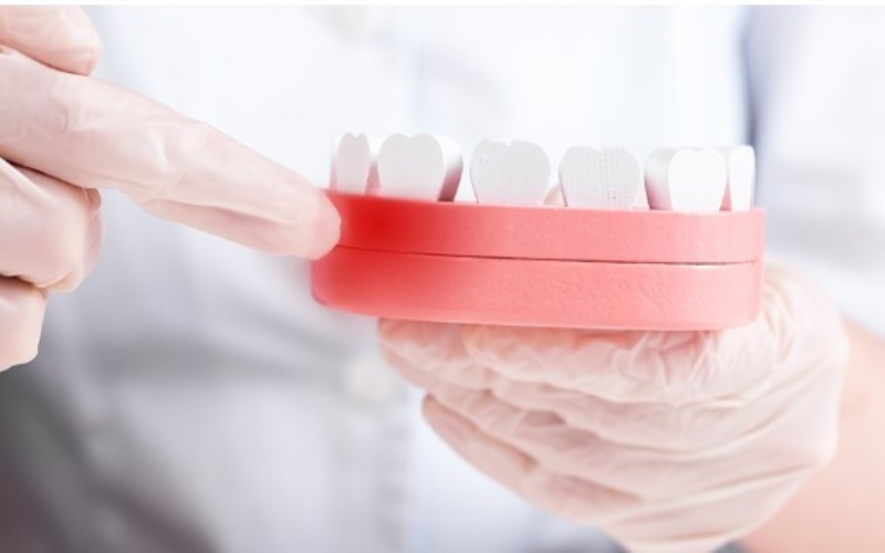 Comprehensive Gum Treatment Solutions in Singapore - Enhancing Oral Health