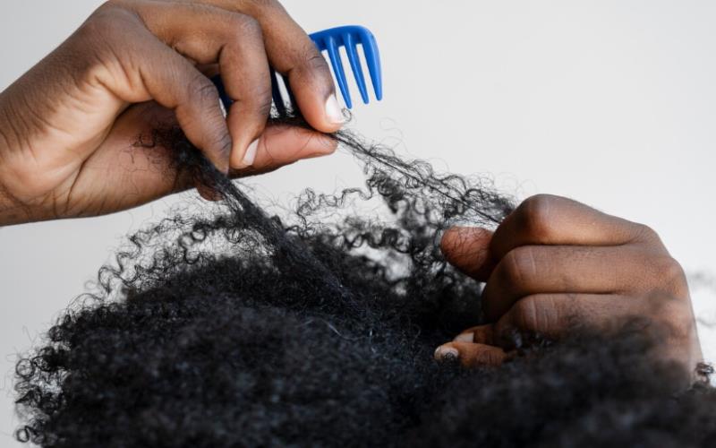Is FUE Hair Transplant Effective for Afro Hair What You Should Know